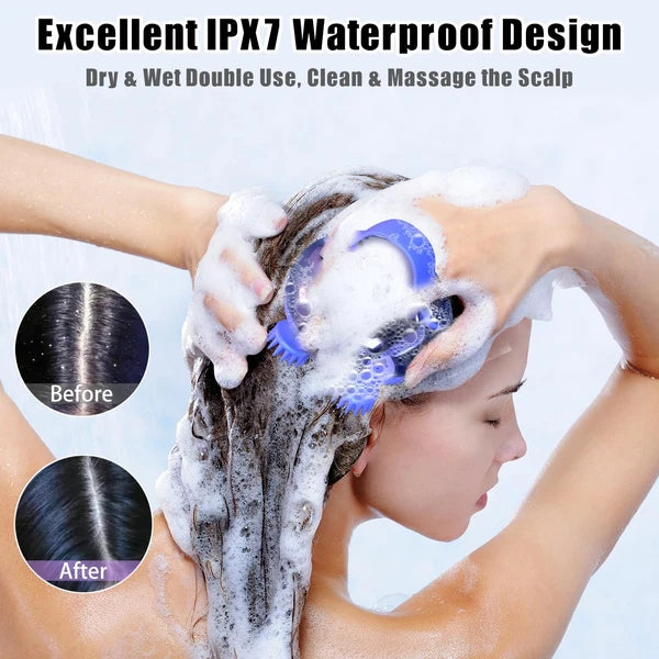 Scalp Massager Electric, Portable Scalp Massager Tool, Waterproof Head Massag...